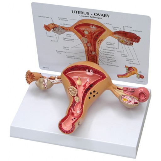 Uterus anatomical model